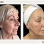 Bafitis Plastic Surgery