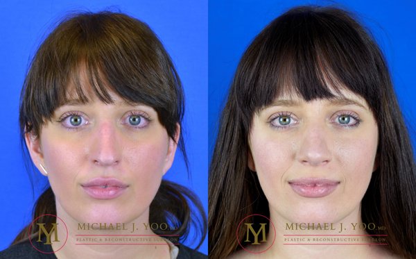 MICHAEL J YOO, MD Newport Beach, CA - Updated November 2024 - 411 ...