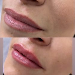West Coast Plastic Surgery Center - Before /after
