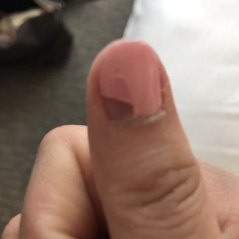 Bliss Nail - Thumb chipped 2 days later - Nail Salons Near Me - Radnor Township, Pennsylvania Bliss Nail - Thumb chipped 2 days later - Nail Salons Near Me - Radnor Township, Pennsylvania