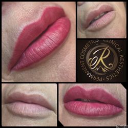 In Skin Renee Krause Clinical Skin Care & Waxing