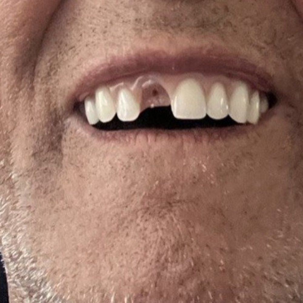 The Dental District - Here again every week!! - Cosmetic Dentists Near Me - Tijuana, BCN The Dental District - Here again every week!! - Cosmetic Dentists Near Me - Tijuana, BCN