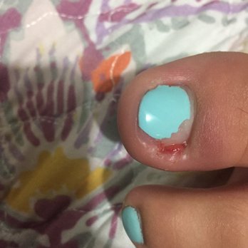 Coco Luxe Nails - They messed up and cut her when doing gel pedi. Still healing and hurts to walk - Eyelash Service Near Me - Santa Monica, California Coco Luxe Nails - They messed up and cut her when doing gel pedi. Still healing and hurts to walk - Eyelash Service Near Me - Santa Monica, California