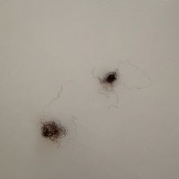 2 balled up strands of hair from two separate braids along my hairline 2 balled up strands of hair from two separate braids along my hairline
