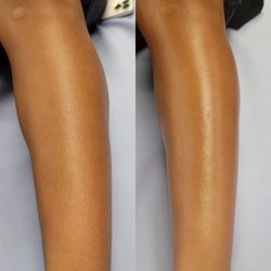 Statue Beauty - Before and after of a leg wax. The after never looked do clean!