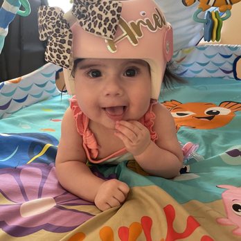 Achilles Prosthetics and Orthotics - Cranial helmet 2months in - Orthotics Near Me - Bakersfield, California