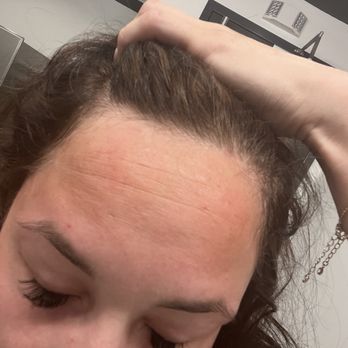 Shell - Bruises and knots on my forehead - Gas Stations Near Me - Grapevine, Texas