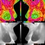Photo of Radiant Body Thermography