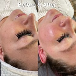 Esthetics by Chelaine