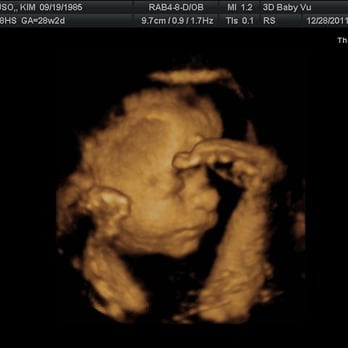 3DBabyVu - 28 weeks side profile and foot - Ultrasound Imaging Centers Near Me - Pleasanton, California 3DBabyVu - 28 weeks side profile and foot - Ultrasound Imaging Centers Near Me - Pleasanton, California