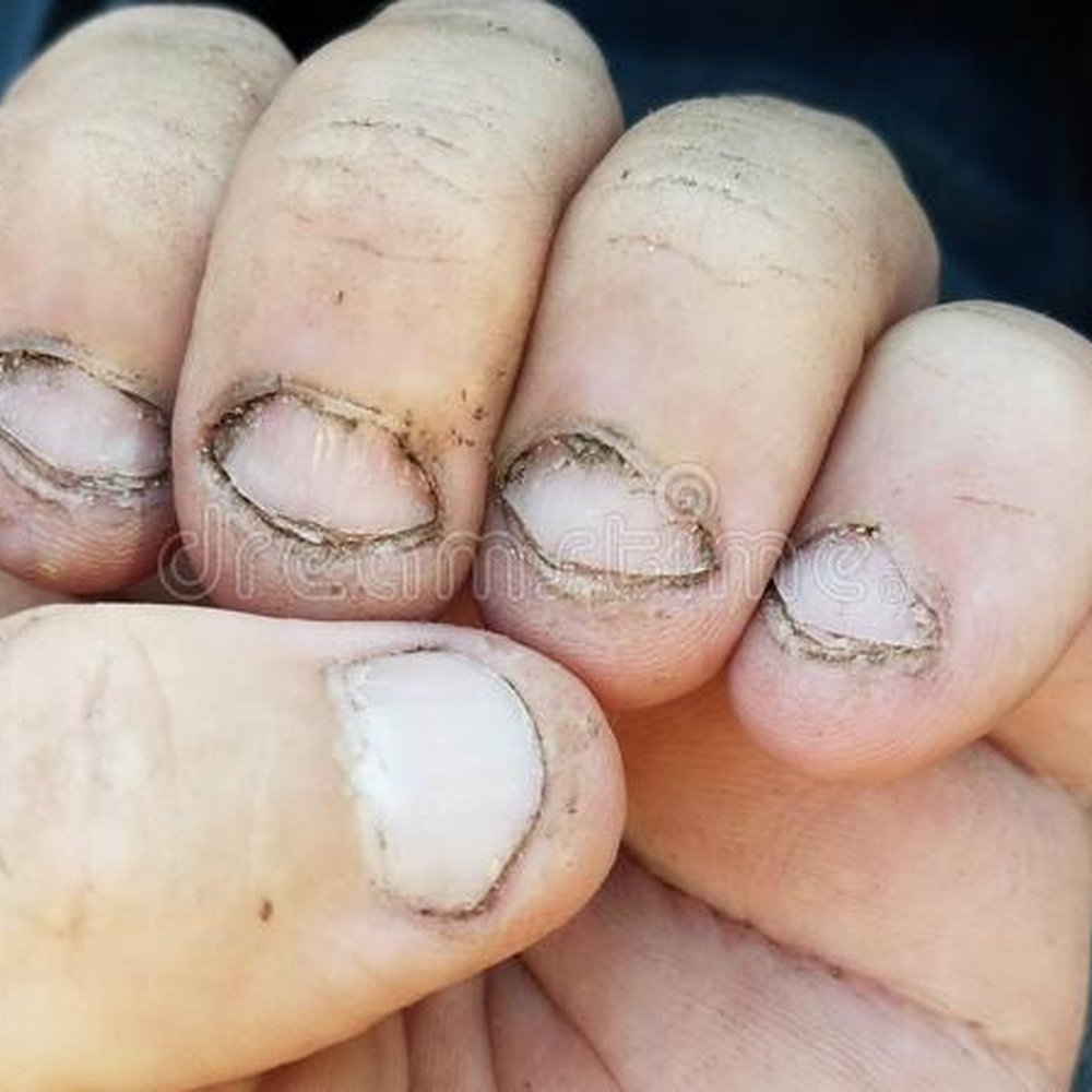 Shell Station - This is how the workers hand & fingernails looked like when she touched my food without any gloves. - Gas Stations Near Me - Porterville, California Shell Station - This is how the workers hand & fingernails looked like when she touched my food without any gloves. - Gas Stations Near Me - Porterville, California