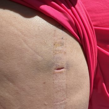 Centennial Ob/Gyn - Incision that did not heal properly, I contacted the doctor for help and he did not reply to my email. - Obstetricians & Gynecologists Near Me - Las Vegas, Nevada