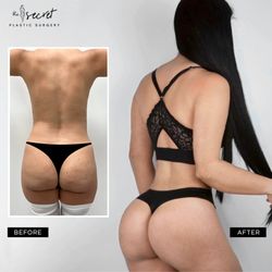 The Secret Plastic Surgery