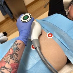 Getting my fat zapped away with Ultrashape
