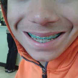 Beautiful smile! proud of his Aqua bands. Beautiful smile! proud of his Aqua bands.
