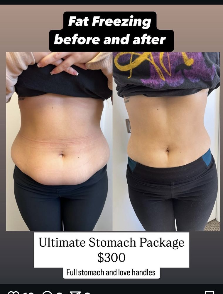 Body Sculpt Clinic Logo