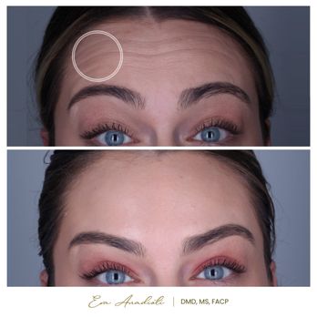 WELNOX Studio - Top Botox Specialist - General Dentistry Near Me - Philadelphia, Pennsylvania WELNOX Studio - Top Botox Specialist - General Dentistry Near Me - Philadelphia, Pennsylvania