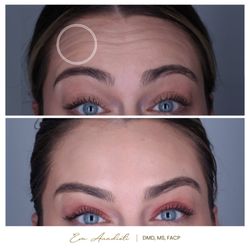 WELNOX Studio - Top Botox Specialist