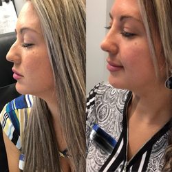 Absolute Aesthetics Rejuvenation Center