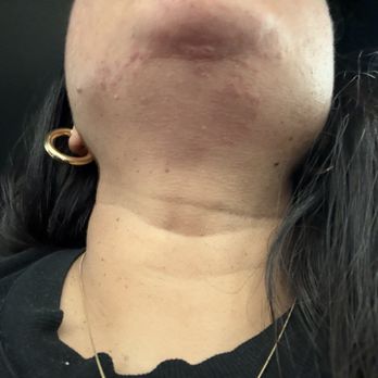Elegant Shapes - Cut from threading - Eyelash Service Near Me - Valencia, California Elegant Shapes - Cut from threading - Eyelash Service Near Me - Valencia, California