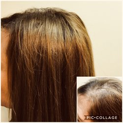 The Hair for Life Center - Before & After