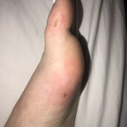 Cut my foot twice by scrubbing too hard after I said it hurt.