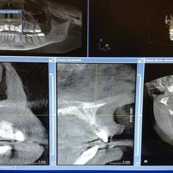 James B. Miller, D.M.D. - This is my 3D scan