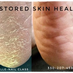 Nail Class - Advanced callus care