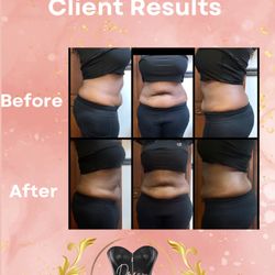 Dream Shape Body Contouring