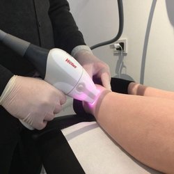 Munich Laser - Hier sieht man eine Behandlung am Unterschenkel in unserem Studio