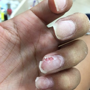Vida Spa - This is when the technician broke my nail after removing my old acrylics . - Nail Salons Near Me - San Fernando, California Vida Spa - This is when the technician broke my nail after removing my old acrylics . - Nail Salons Near Me - San Fernando, California