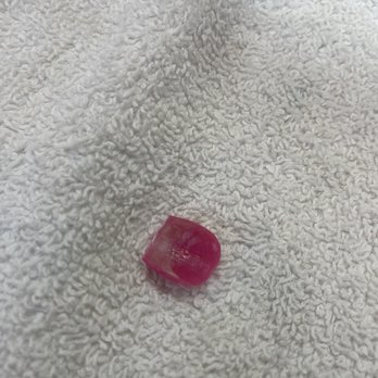 Nail Envy - Ripped nail during removal - Nail Salons Near Me - Chicago, Illinois