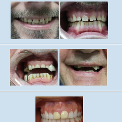 Rock Creek Dental - Before