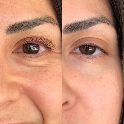 Self Care is Skin Care - Here are some of those we've helped with their skin care routine and the results they've seen. Self care is skin care and we are the premier specialist here at Undercover Glow. Feel confident and beautiful everyday. Request consultation and find out what we can do for you! Self Care is Skin Care - Here are some of those we've helped with their skin care routine and the results they've seen. Self care is skin care and we are the premier specialist here at Undercover Glow. Feel confident and beautiful everyday. Request consultation and find out what we can do for you!