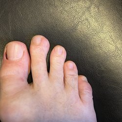 Venus Foot Spa - Way too deep when removing the cuticles. Next morning...