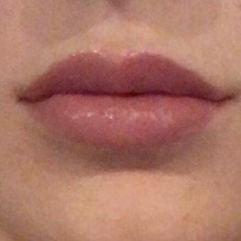 About Face Aesthetics - Relaxed - Skin Care Near Me - Philadelphia, Pennsylvania About Face Aesthetics - Relaxed - Skin Care Near Me - Philadelphia, Pennsylvania