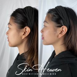Skin Heaven Aesthetics & Wellness - Feel your best after a self-care treatment at Skin Heaven Med Spa