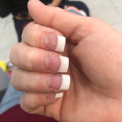 Sad looking nails