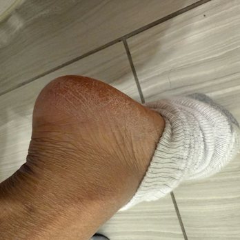 Get Nailed - Heels are cracking and dry. Paid $55.00 for deluxe pedicure and less than a week. - Nail Salons Near Me - Las Vegas, Nevada Get Nailed - Heels are cracking and dry. Paid $55.00 for deluxe pedicure and less than a week. - Nail Salons Near Me - Las Vegas, Nevada