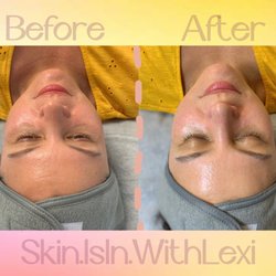 Skin.IsIn.WithLexi