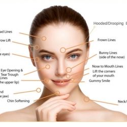 Skin Care Empire - Plasma Skin Tightening - Treated Facial Areas