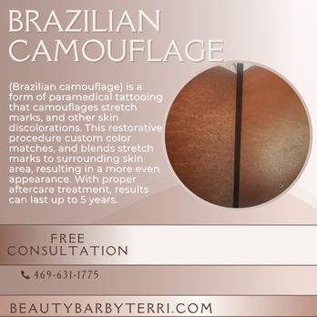 Beauty Bar by Terri - Stretch mark camouflage on all skin tones. - Permanent Makeup Near Me - Dallas, Texas Beauty Bar by Terri - Stretch mark camouflage on all skin tones. - Permanent Makeup Near Me - Dallas, Texas