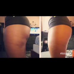 Suddenly Slender Body Wraps TM - Cellulite Beware!!!