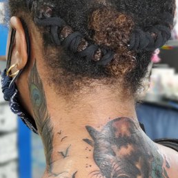 After2 - left side of neck (there's swelling in this picture but nothing distorted) After2 - left side of neck (there's swelling in this picture but nothing distorted)