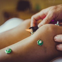 Intuitive Acupuncture