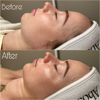 Abosoyoki - After Facial Glow - Skin Care Near Me - New York, New York Abosoyoki - After Facial Glow - Skin Care Near Me - New York, New York