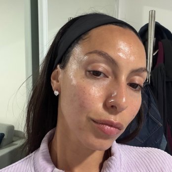 Astra Aesthetic Center - Skin Care Near Me - Redondo Beach, California Astra Aesthetic Center - Skin Care Near Me - Redondo Beach, California