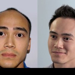 DiStefano Hair Restoration Center