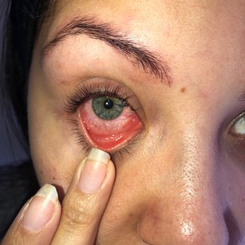 Lash Boutique - Lash lift glue in my eye - Eyelash Service Near Me - Sarasota, Florida