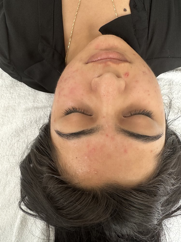 THE SKIN CARE CLINIC 52 Photos & 72 Reviews 1475 Burlingame Ave